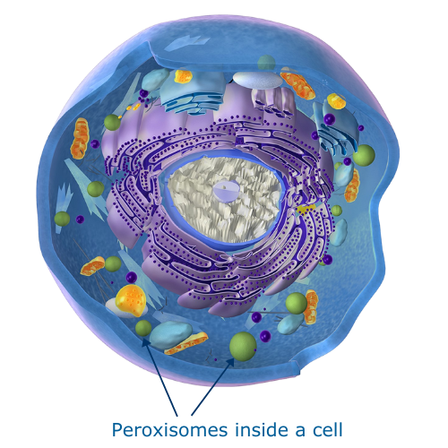 Peroxisomal Biogenesis Disorder-Zellweger Spectrum Disorder (PBD-ZSD ...